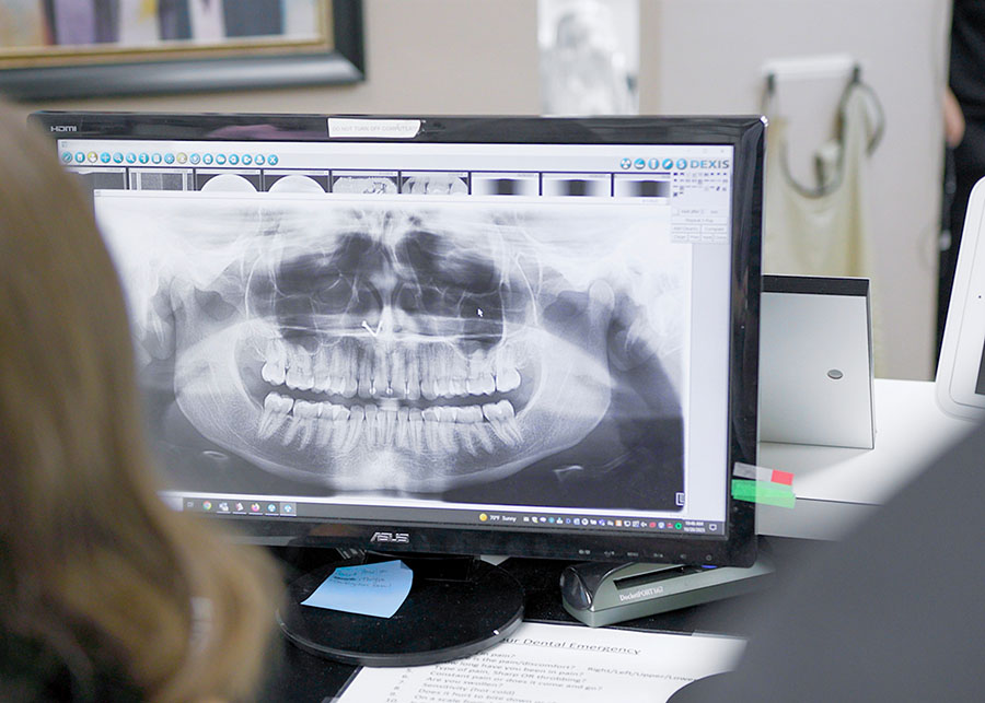 Root Canals Jacksonville And Live Oak Florida Dentists