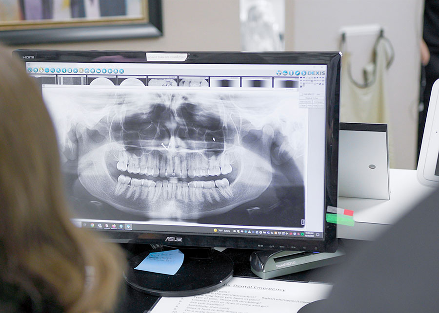 Root Canals Dentists in Jacksonville & Live Oak, FL